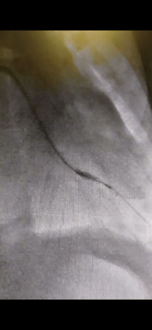202212011123450632.gif